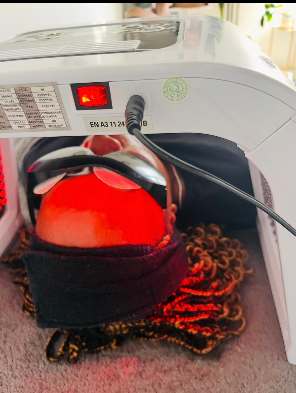 Photo Dynamic Therapy red light treatment at VITO Med